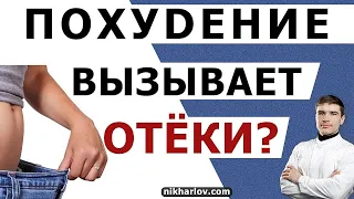 Почему образуются отёки во время похудения. Чем больше потеря веса, тем больше задержка жидкости