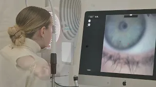 OS1000 Corneal Topography with Dry Eye Assessment - Overview - Reichert AMETEK Eye Care | SBM