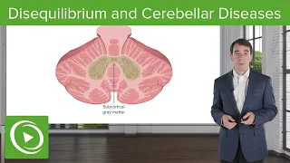 Disequilibrium and Cerebellar Diseases