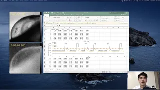 How to analyze intracellular calcium recording using imageJ