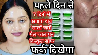 रात में इस तरीके से लगाएं और पाएं गोरी ग्लोइंग स्किन how to use Vitamin E/ capsule uses of Vitamin E