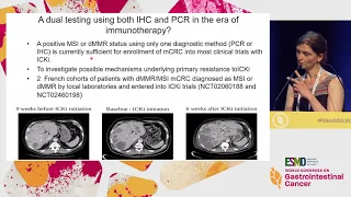 Colorectal Cancer: MSI Testing to All Patients and How to Test