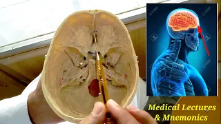 anterior cranial fossa