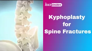 Kyphoplasty for Spine Fractures