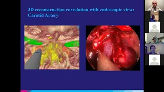 Medical Student Lecture Series - Skull Base