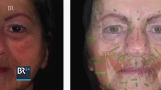 2400 Jahre altes Gesicht – Mumie rekonstruiert | BR24