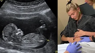 BREAKING: Justin Bieber & Hailey Baldwin Share Pregnancy News!