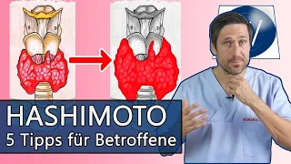 Probleme mit Hashimoto & der Schilddrüse? Dinge auf die Sie unbedingt achten sollten: Meine 5 Tipps!