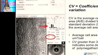 AIOC2019 - GP127 - Celebrating 200 years of Indian Ophthalmology - ( Cornea )