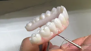 Implant Bridges Zirconia Monolithic Double Full Arch Tutorial