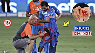 Top 7 Worst Injuries in Cricket History