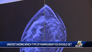 Understanding which type of mammogram is right for you
