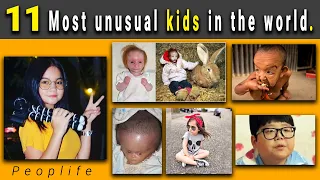 11 Most unusual kids that actually exist in the world | Peoplife