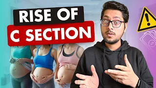 Why are C-section deliveries rising in India? 🇮🇳 | Open Letter