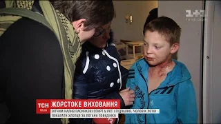 Проти вітчима, який налив дитині в рот спирт та підпалив, відкрито кримінальне провадження