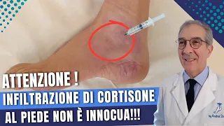 ⚠️ ATTENZIONE!!! INFILTRAZIONE DI CORTISONE AL PIEDE NON È INNOCUA! | Dott. Andrea Scala