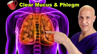 1 Cup CLEARS UP Mucus & Phlegm...Open Airways & Lungs | Dr. Mandell