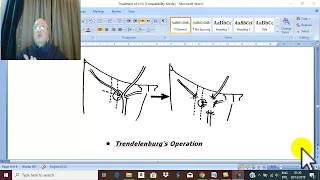 Venous Disorders in English 15 ( Varicose veins , treatment 2 ) , by Dr.Wahdan