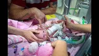 Baby born with heart outside her body