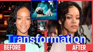 🔥"Rihanna's Stunning Transformation: Plastic Surgery for ASAP Rocky? | Essential News"😱