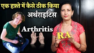 Cured Rheumatoid Arthritis in One Week । Kaise thik kiya Rheumatoid Arthritis ? । Healthcity