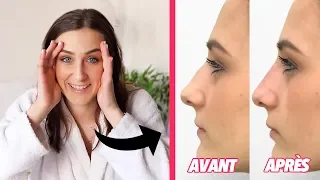 MON NOUVEAU NEZ (ma rhinoplastie médicale)