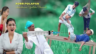 Must watch injection funny videos amazing doctor comedy। Doctor Funny Video। Ep 1 by Xoss Polapan