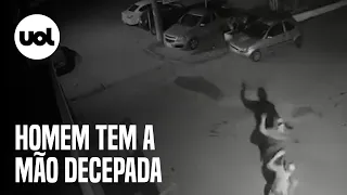 Homem tenta separar mulher de agressor e tem a mão decepada em Brasília