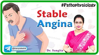 Stable Angina: Causes, Pathophysiology, Symptoms, Diagnosis and Treatment ( Internal medicine )