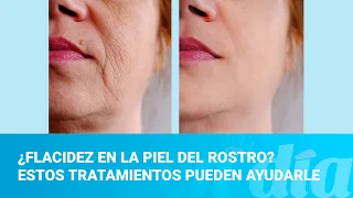 ¿Flacidez en la piel del rostro? Estos tratamientos pueden ayudarle