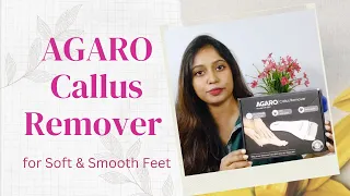 Agaro Callus Remover | callus remover | callus remover electric machine | how to use callus remover