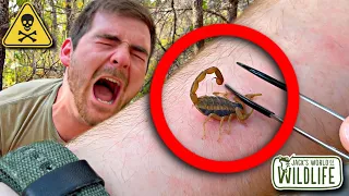 STUNG By A BARK SCORPION! How Bad Is IT?