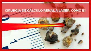 Cirurgia de Cálculo Renal a Laser, Como É?
