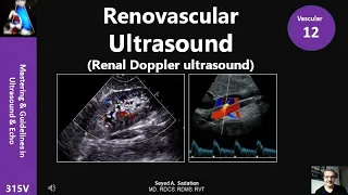 Renovascular Ultrasound (Renal Doppler ultrasound) 1: normal