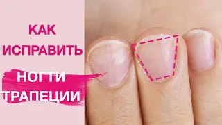 Manicure on Short Trapezoidal Nails | How to Fix Them