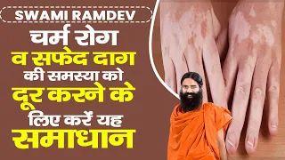 चर्म रोग (Skin Disease) व सफेद दाग की समस्या को दूर करने के लिए करें यह समाधान || Swami Ramdev