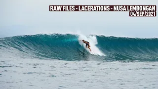 When will you ever see it this empty again? - Lacerations - Nusa Lembongan - RAWFILES - 04/SEPT/2021