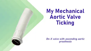 My Mechanical Aortic Valve Ticking Sound