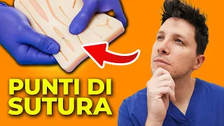 PUNTI DI SUTURA: Quale Scegliere in base alla Cicatrice (TUTORIAL COMPLETO)