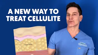 What YOU Need to Know about QWO: Injectable Treatment for Cellulite