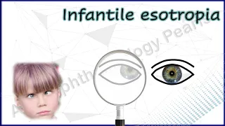 Infantile Esotropia Simplified 1│Understanding Various Phenomena & Differential Diagnosis