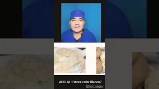 Tengo heces Color Blanco ¿que hago?