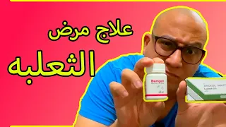 مرض الثعلبه:  فهم المرض و علاجه (مهم جدا)(الجزء الثاني)