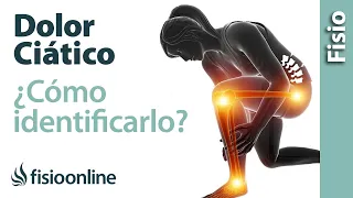 Cómo saber si tienes una CIÁTICA o dolor del nervio ciático