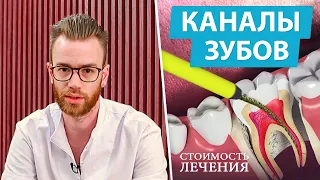 Сколько стоит лечение каналов зуба? (периодонтитпульпит)