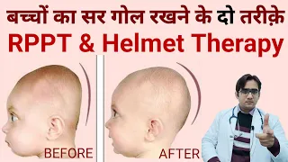 Flat Head Prevention and Treatment | बच्चे का सिर गोल कैसे करें | Plagiocephaly | Dr Md Noor Alam