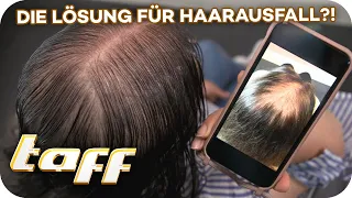 Kein Haarausfall mehr! Neue Haar-Wachstumsbehandlung? | taff | ProSieben