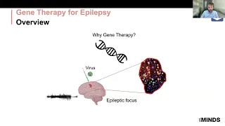 Novel ways to treat the brain with gene therapy