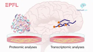 Reconstructing Lewy body formation offers insight into Parkinson’s disease