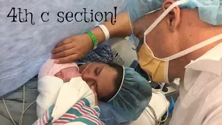 4th CSECTION!  tips and recovery what to expect from a csection